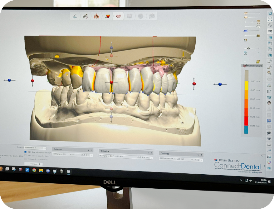 Écran 3D prothèse - Laboratoire numérique